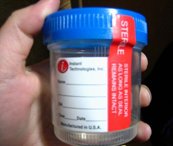 photo of How Synthetic Urine Became the Go-To for Beating Drug Tests image
