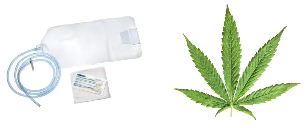 photo of Study: CBD Enema Linked to Significant Symptom Improvements in Patients With Ulcerative Proctitis image