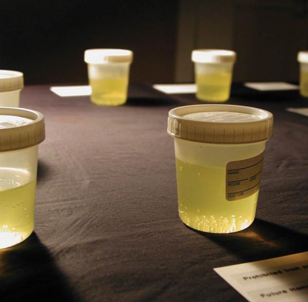 photo of Vinegar blocks cannabis from some urine tests image